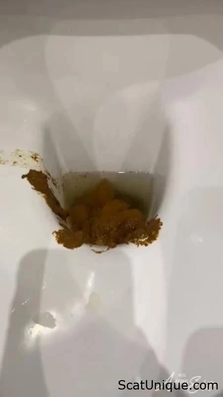 An Excess Of Shit In The Commode. P1